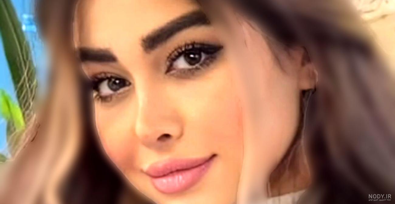 عکس حامیم تصادف