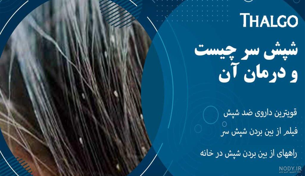 عکس شپش مو عکس شپش مو