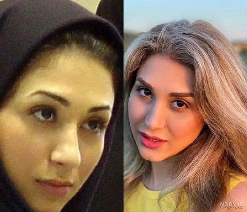 عکس قبل عمل خانم مجری شبکه سه/فروزان بیگی - BEDINSAN