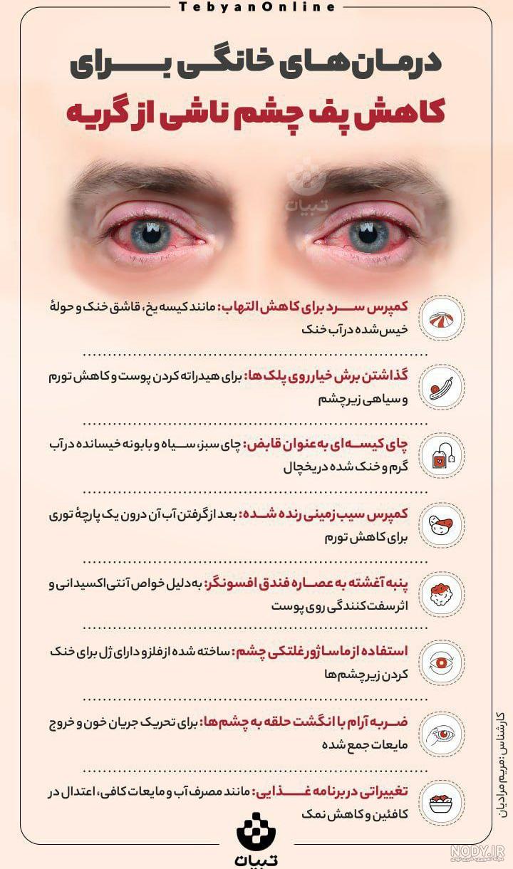 عکس گریه چشم عکس گریه چشم