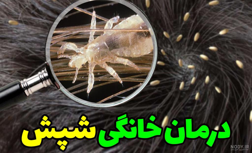 نمای نزدیک و جالب از مکیدن خون انسان توسط شپش نمای نزدیک و جالب از مکیدن خون انسان توسط شپش