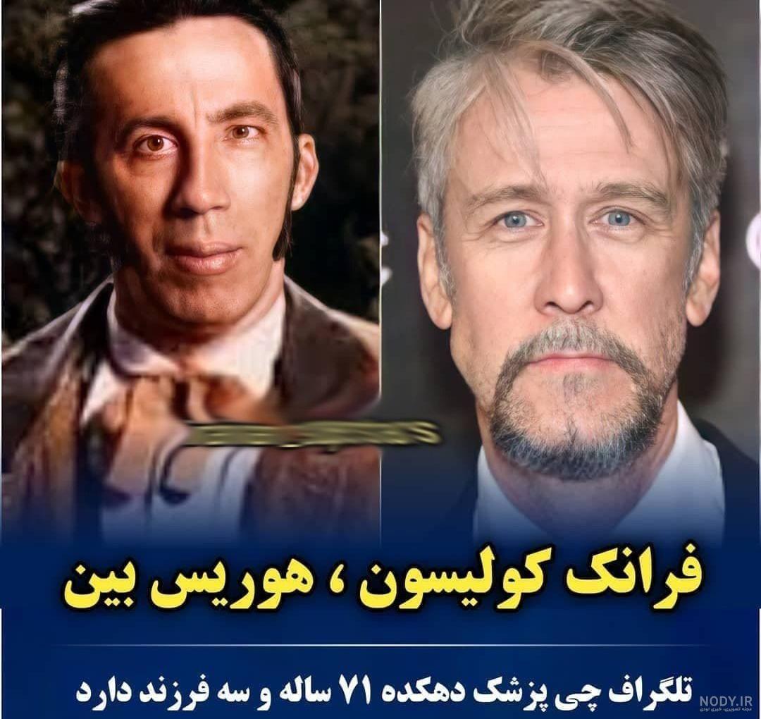 چهره شیک بازیگر خردسال پزشک دهکده بعد از 35 سال چهره شیک بازیگر خردسال پزشک دهکده بعد از 35 سال