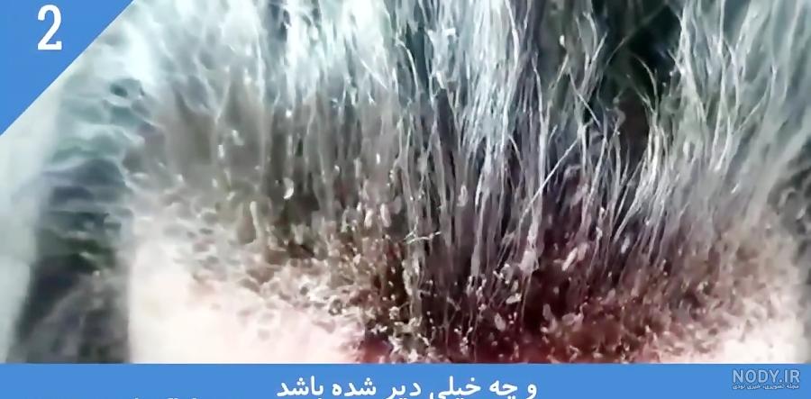 گالری عکس شپش گالری عکس شپش