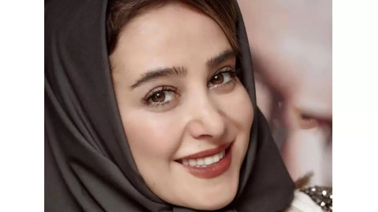 عکس قبل عمل الناز حبیبی سوژه شد | عکس الناز حبیبی قبل و بعد از عمل زیبایی عکس قبل عمل الناز حبیبی سوژه شد | عکس الناز حبیبی قبل و بعد از عمل زیبایی