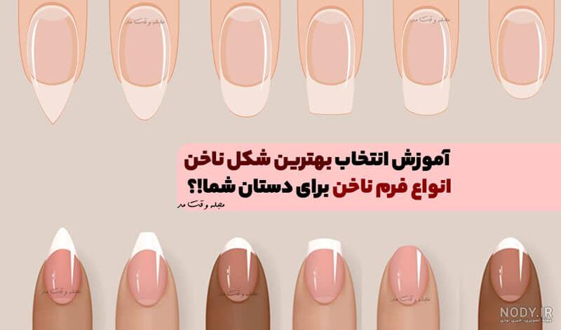 کاشت ناخن و معرفی روش های آن، نمونه تصاویر زیبای کاشت ناخن کاشت ناخن و معرفی روش های آن، نمونه تصاویر زیبای کاشت ناخن