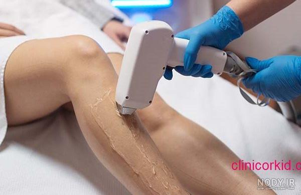 دستگاه لیزر الکساندرایت با مشخصات فنی و ویژگی های منحصر به فرد و کاربردها و استفاده های آن. دستگاه لیزر الکساندرایت با مشخصات فنی و ویژگی های منحصر به فرد و کاربردها و استفاده های آن.