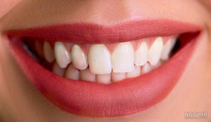 عکس دندان های سفید و لبخند زیبا مدل عکس دندان های سفید و لبخند زیبا مدل