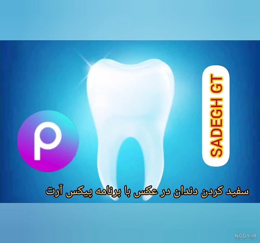 عکس دندان سفید و مرتب عکس دندان سفید و مرتب