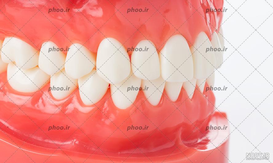 عکس دندانهای سفید - عکس نودی عکس دندانهای سفید - عکس نودی