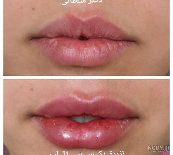 لب چه فرمی قشنگه؟ صفحه 2 | تبادل نظر نی نی سایت لب چه فرمی قشنگه؟ صفحه 2 | تبادل نظر نی نی سایت