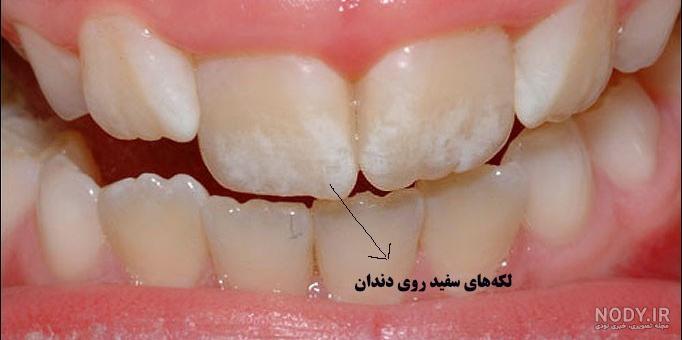 نحوه سفید کردن دندان با نرم افزار فتوشاپ + آموزش تصویری برای مبتدیان نحوه سفید کردن دندان با نرم افزار فتوشاپ + آموزش تصویری برای مبتدیان