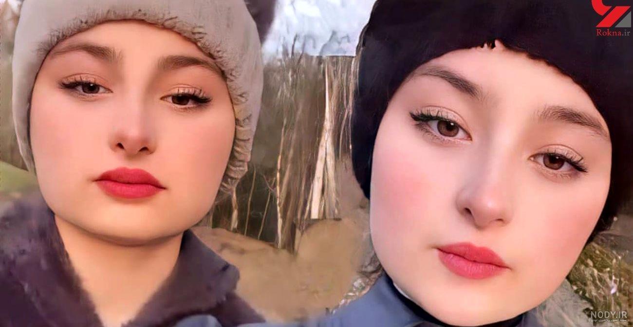 نیکا فلاحی قبل عمل مدیونه هرکی ببینه فالو نکنه