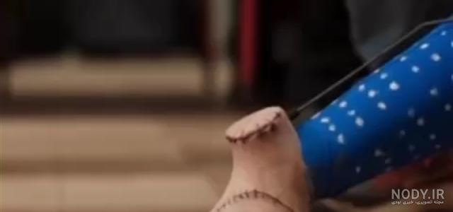 عکس از تینگ در ونزدی