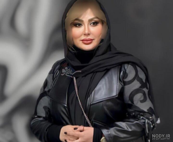 تغییر چهره حیرت انگیز نیوشا ضیغمی بازیگر سریال در چشم باد بعد 20 سال /  جوانتر و جذاب تر !