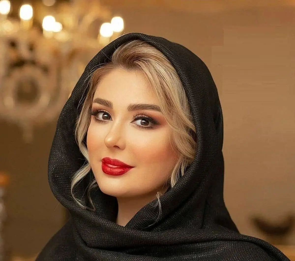 صورت نیوشا ضیغمی | تصویر جنجالی از صورت خونین نیوشا ضیغمی