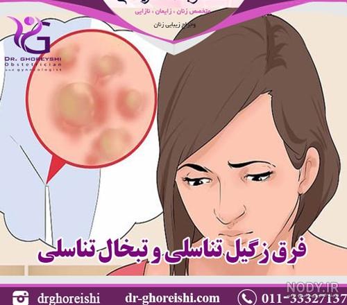 عکس ویروس هرپس تناسلی