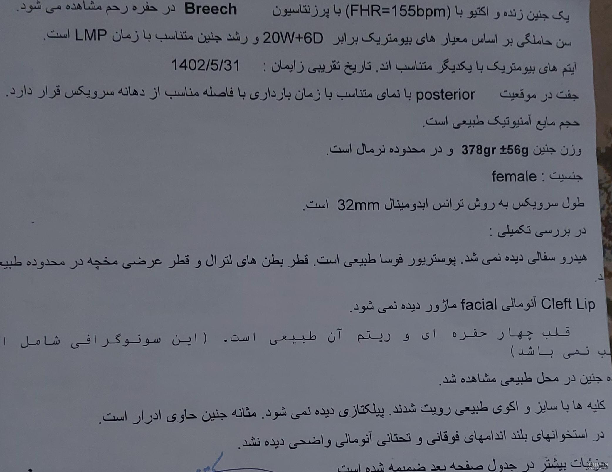 عکس سونو انتی پسر نی نی سایت