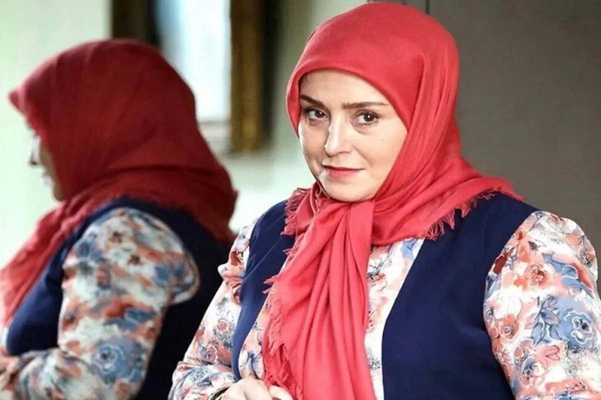 عمل زیبایی ژاله صامتی که از این رو به اون رو شده! | قبل و بعد