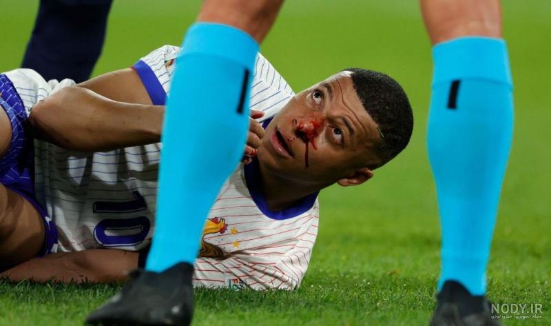 امباپه و همسرش در ساحل