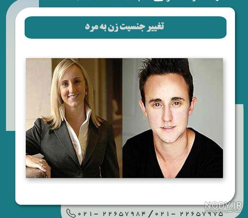 انیمیشن چگونگی جراحی تغییر جنسیت