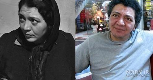 ترنسی که عمل جراحیش خراب شد!