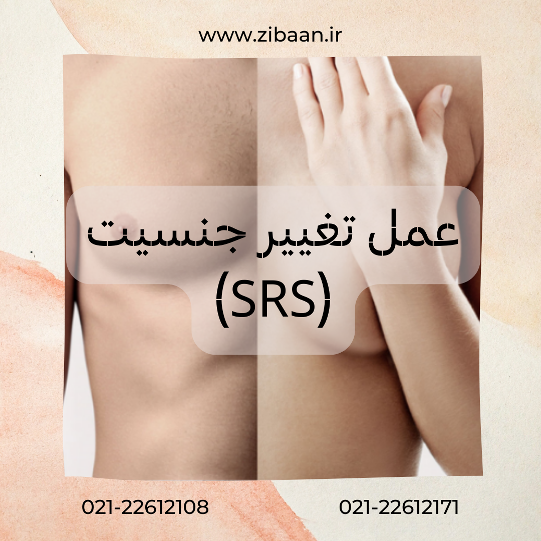 تغییر جنسیت چیست و در ایران چگونه است؟ انواع عمل و مراحل آن