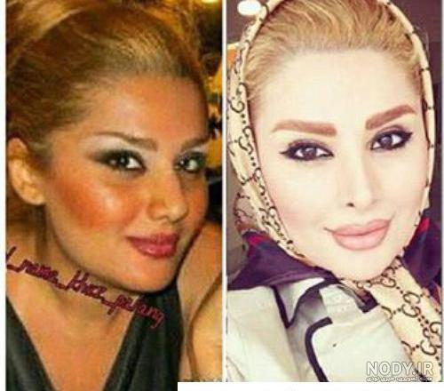 دنیا جهانبخت کیست؟ عکس های او و دلیل حامله شدنش از مهراد جم - تاینی نیوز