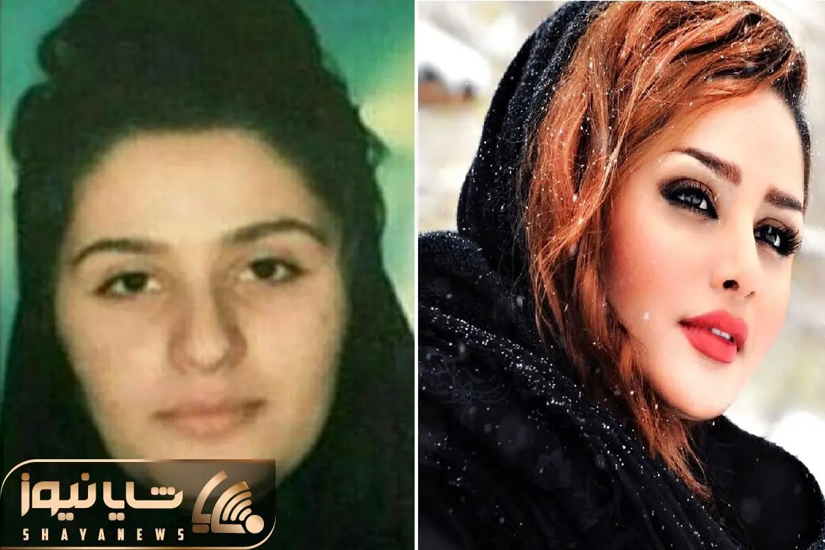 🎉🎉زیبایی،بازیگران، پیج متنوع🌟‎ | ‎زلیخا قبل عمل 😉😍😍 عکسهای بیشتر در  پیجمون ببینید 👇👇👇 . . @fashion_stylish1999 @fashion_stylish1999 . . .‎ |  Instagram