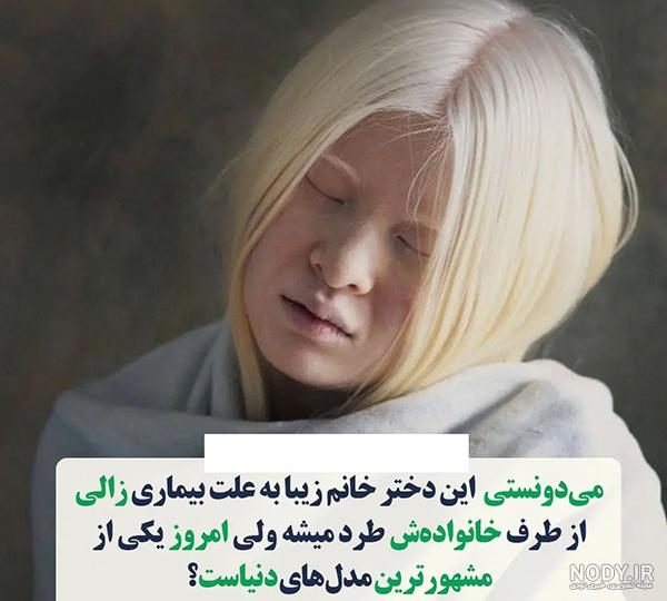 عکس دختر | 150 متن و عکس دخترونه زیبا و لاکچری برای پروفایل- دلبرانه عکس دختر | 150 متن و عکس دخترونه زیبا و لاکچری برای پروفایل- دلبرانه