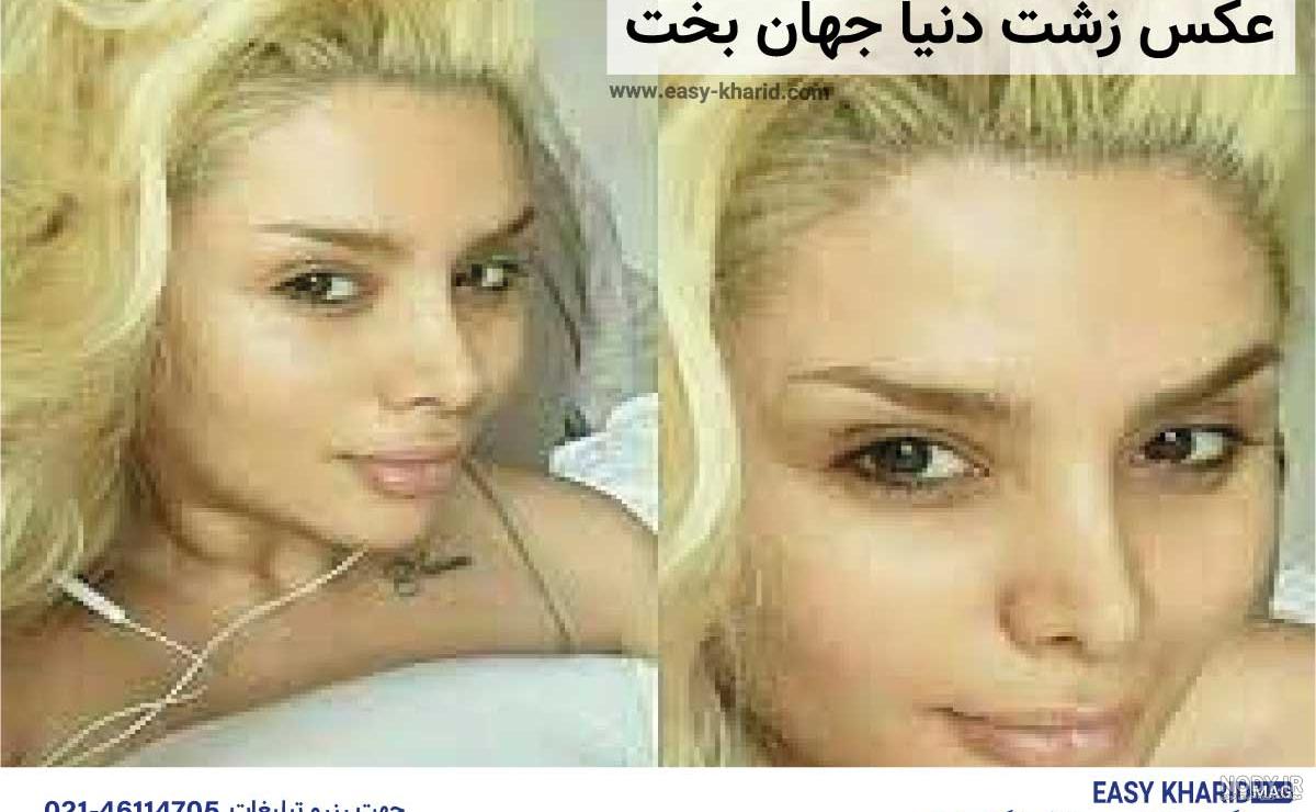 عکس دنیا جهانبخت قبل و بعد عمل زیبایی