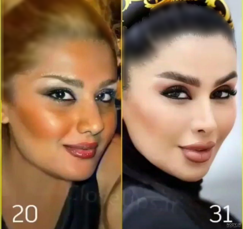 عکس دنیا جهانبخت قبل عمل زیبایی