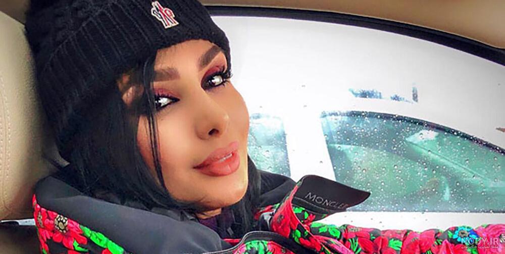 عکس زیرخاکی از دنیا جهانبخت / قبل از عمل خیلی زشت بود !