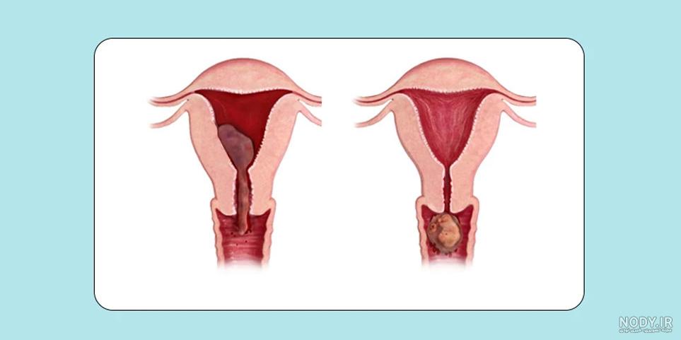 هفته دوم بارداری - علائم، وضعیت جنین و تغذیه در هفته دوم بارداری | مجله هومکا هفته دوم بارداری - علائم، وضعیت جنین و تغذیه در هفته دوم بارداری | مجله هومکا