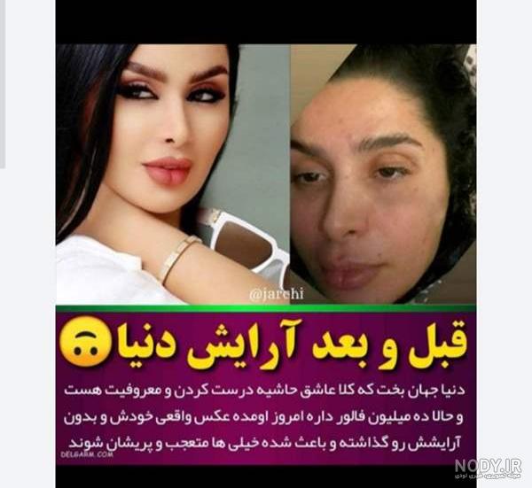 چهره دنیا جهانبخت قبل از عمل های زیبایی / آرتام به پدرش رفته است !