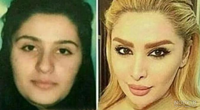 کتک کاری وحشتناک دنیا جهانبخت و مهراد جم + عکس باورنکردنی