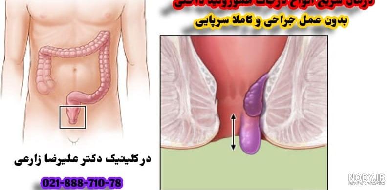 عکس داخل شکم عکس داخل شکم