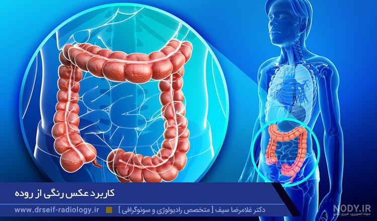 عکس داخل شکم انسان واقعی عکس داخل شکم انسان واقعی