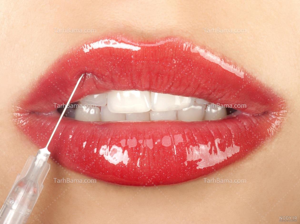 عکس لب ژل زده طبیعی عکس لب ژل زده طبیعی