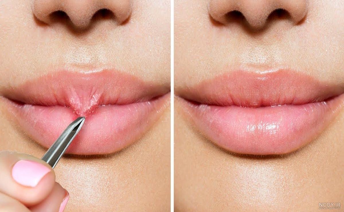 عکس لب ژله ای عکس لب ژله ای