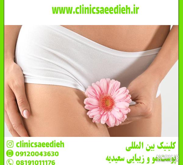 آناتومی و عکس آلت تناسلی مردان | مجله سلامت کیوان آناتومی و عکس آلت تناسلی مردان | مجله سلامت کیوان