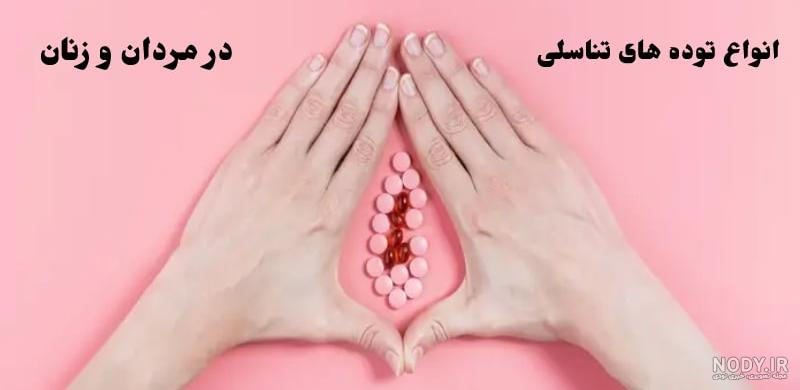 آیا آلت تناسلی من نرمال است؟ اندازه، شکل، استحکام و انحنا - دکتر علی اکبر کرمی آیا آلت تناسلی من نرمال است؟ اندازه، شکل، استحکام و انحنا - دکتر علی اکبر کرمی