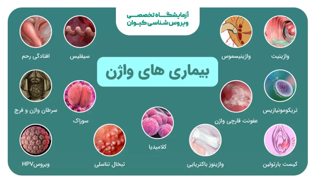 اسم تمام اعضای بدن زن با عکس