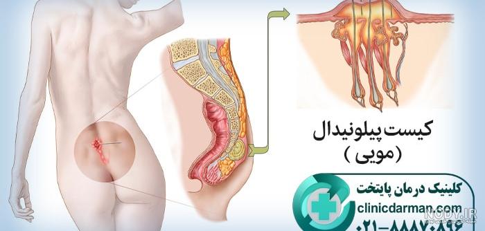 شکل آلت تناسلی زنان و آناتومی واژن چگونه است؟ - دکتر زهرا سعادتی متخصص جراحی و لیزر