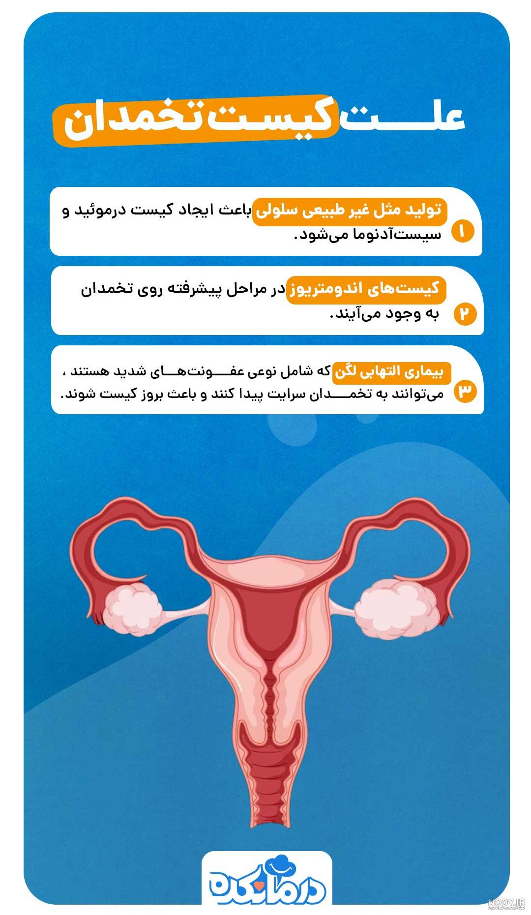 عکس کیست درموئید