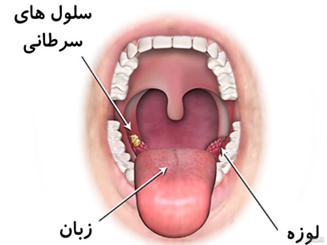این نشانه ها روی زبان یعنی سرطان گرفته اید! این نشانه ها روی زبان یعنی سرطان گرفته اید!