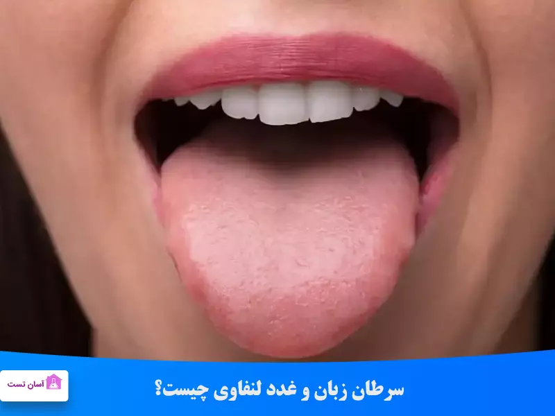 بیماری های زبان را جدی بگیرید!! (تشخیص و درمان) بیماری های زبان را جدی بگیرید!! (تشخیص و درمان)