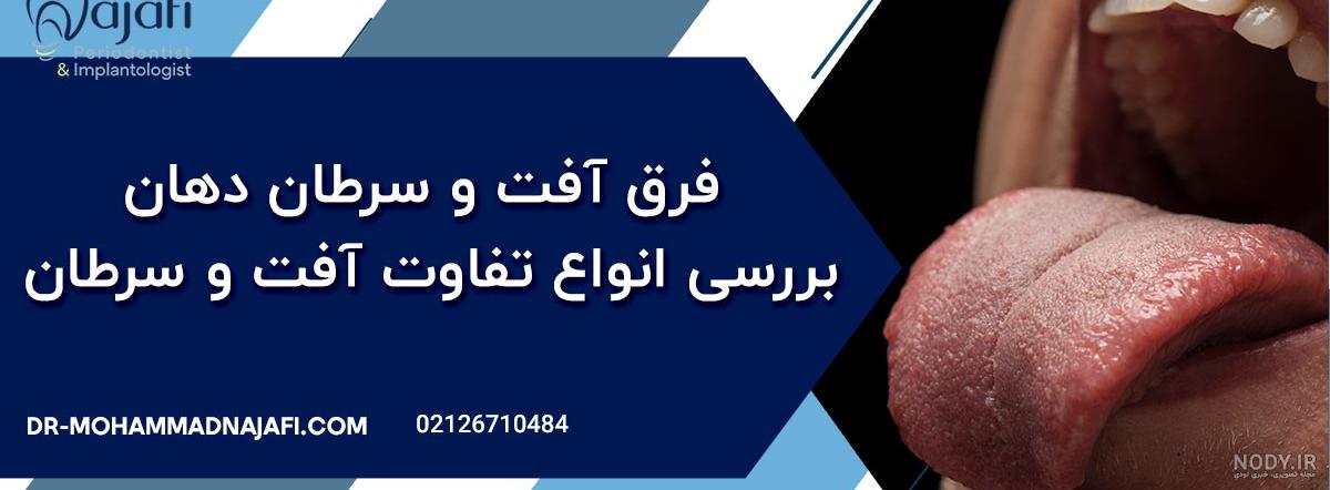 سرطان دهان - دکتر امید امیربنده متخصص جراحی لثه و ایمپلنت در تهران - پریودنتیست تهران سرطان دهان - دکتر امید امیربنده متخصص جراحی لثه و ایمپلنت در تهران - پریودنتیست تهران