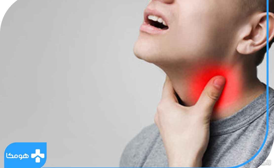 سرطان زبان و سرطان های متاستاتیک ناحیه دهان - شرکت سما تشخیص آریا سرطان زبان و سرطان های متاستاتیک ناحیه دهان - شرکت سما تشخیص آریا