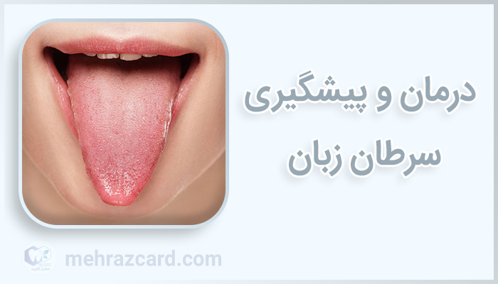 سرطان گلو و دانستنی‌های آن + آیا سرطان گلو کشنده است؟ | مجله هومکا