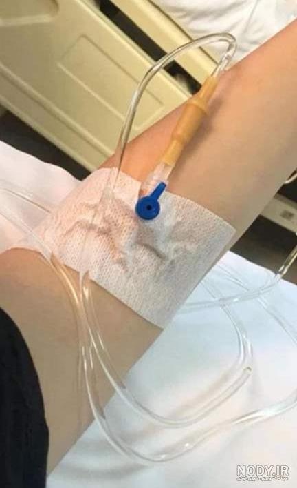 عکس خفن عکس سرم آویزان شده